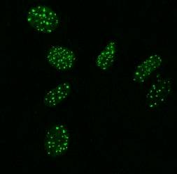 创新参选:哺乳动物细胞爬片免疫荧光染色中的