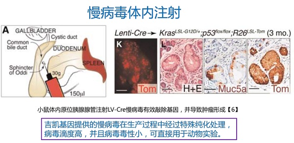 胰腺癌研究体内外模型综述 -胰腺癌|模型|吉凯-