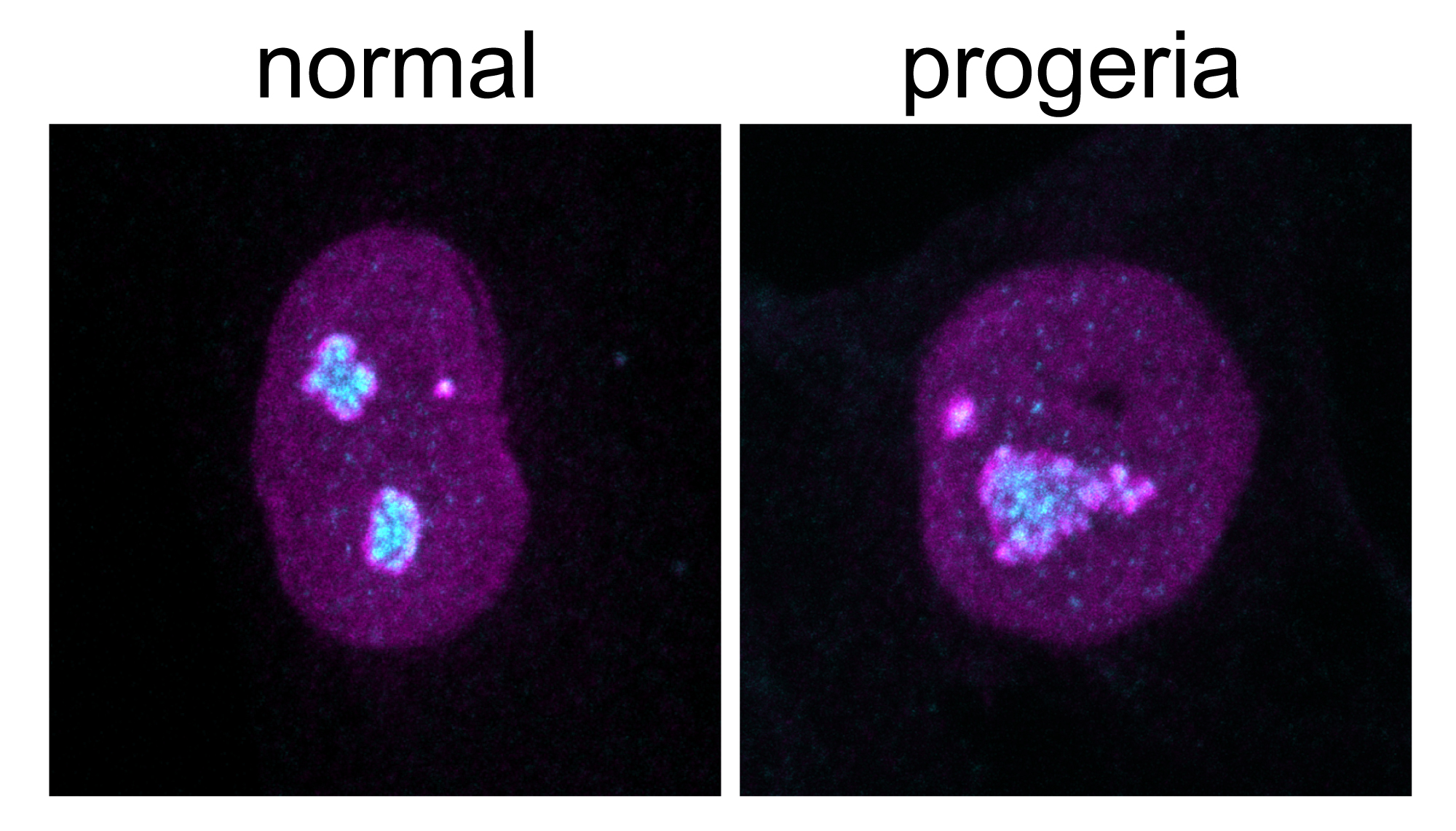 最新抗衰老靶点:控制蛋白质组代谢 -衰老|蛋白质周转|核仁|SILAC|质谱|核纤层蛋白|lamin A|lamin B|核糖体|蛋白质组|-生物通