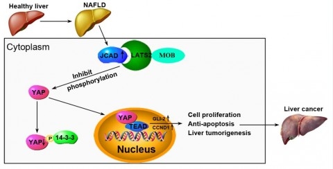 旦大学Cancer Res发表非酒精性脂肪性肝炎所
