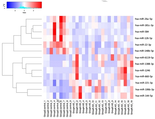 山大附属医院:血清中microRNA作为早期诊断阿
