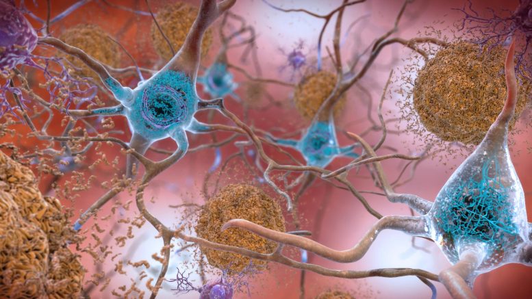 beta-amyloid protein in the brain form plaques
