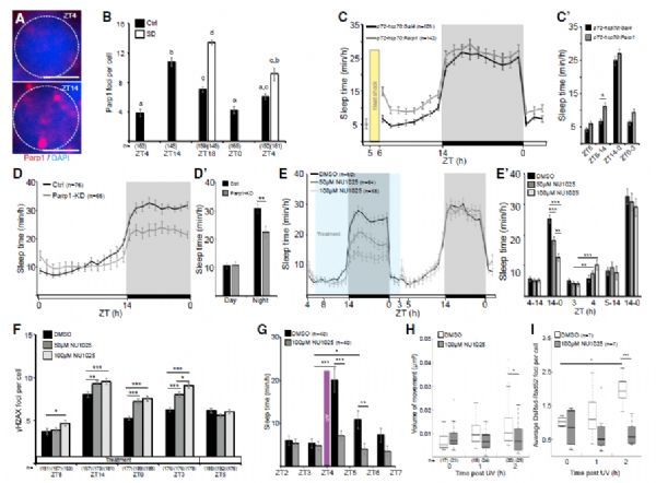 The sleep signal from the body is actually an "alert" of brain DNA damage