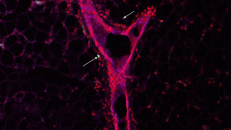 Breast Epithelial Cells