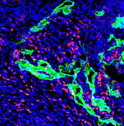 Lymphatics aid heart repair