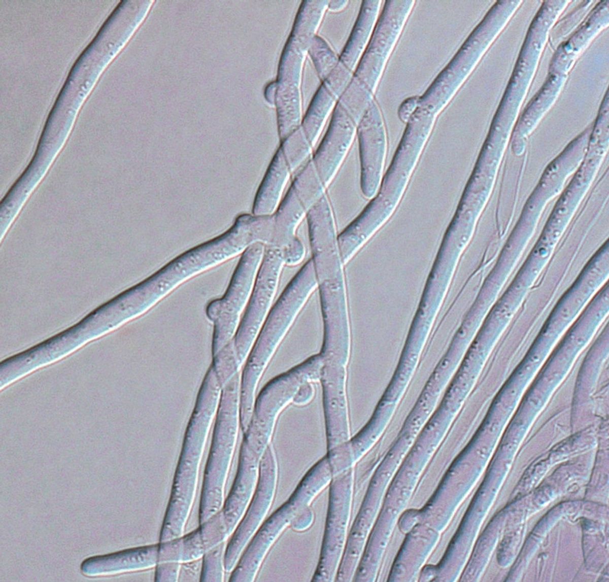 Microscopic image of joined hyphae