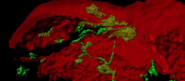 Breast cancer: why metastasis spreads to the  bone