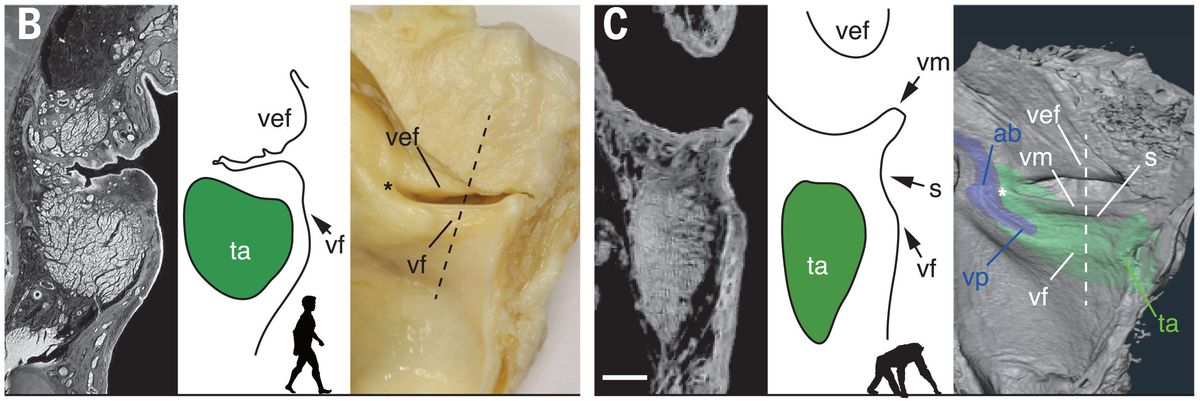 Vocal anatomy in humans and chimpanzees