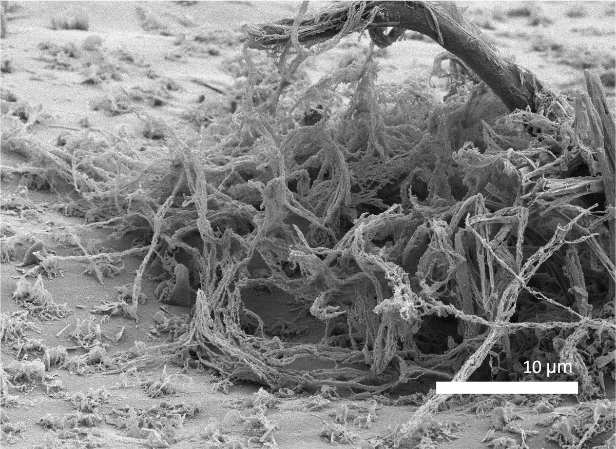 Microscopic image showing the fungus��s filaments