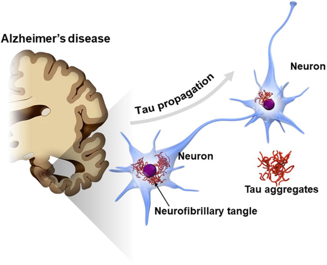 Molecular Psychiatry: Blood tests for Alzheimer's disease are different for men and women!