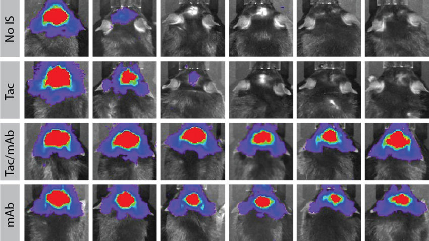 scan color brain stem