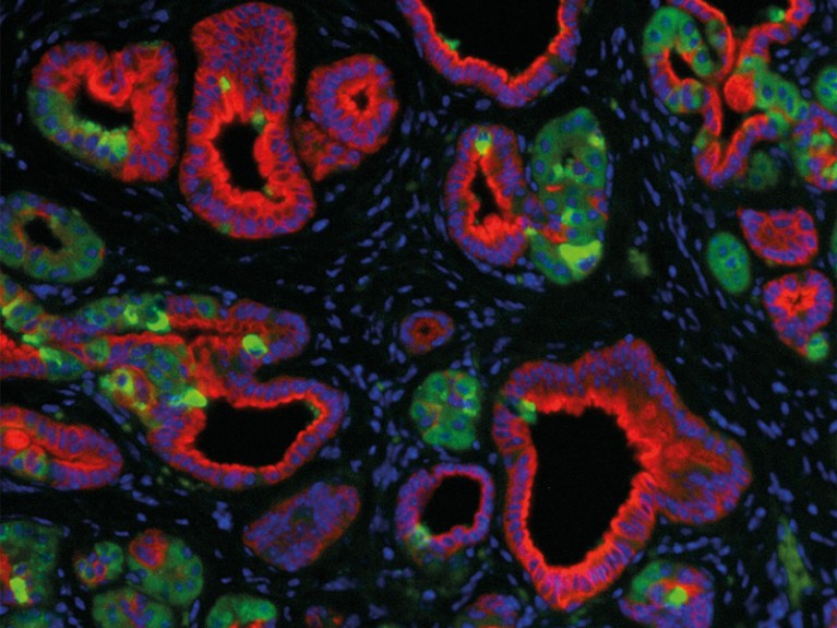 Microscopy image from a G12C mouse.