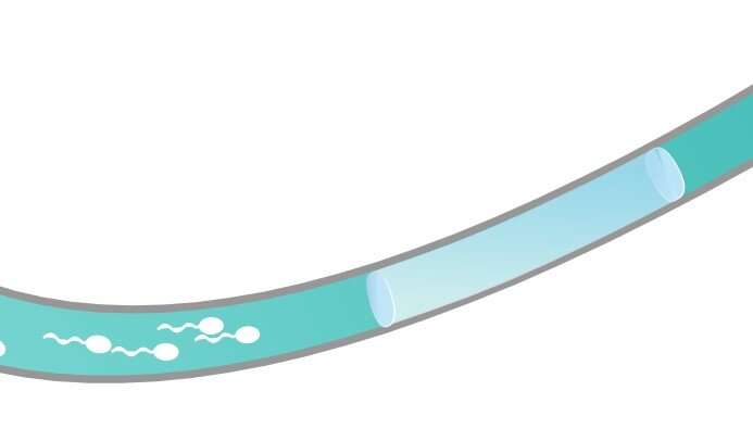 New male contraceptive does not involve hormones