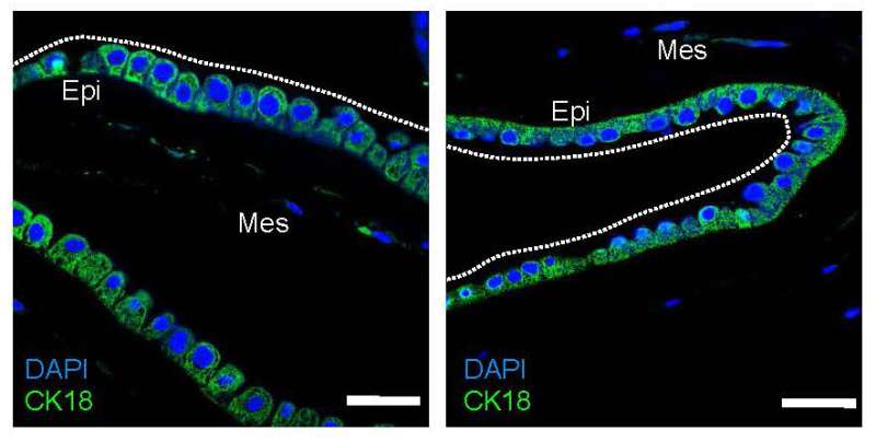 A secret of developing life: In some instances the fetus helps repair a ruptured amniotic sac