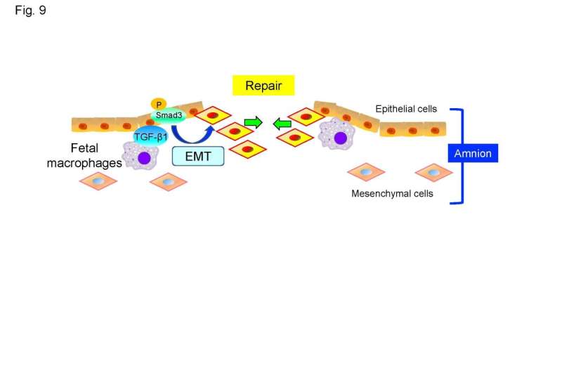 A secret of developing life: In some instances the fetus helps repair a ruptured amniotic sac