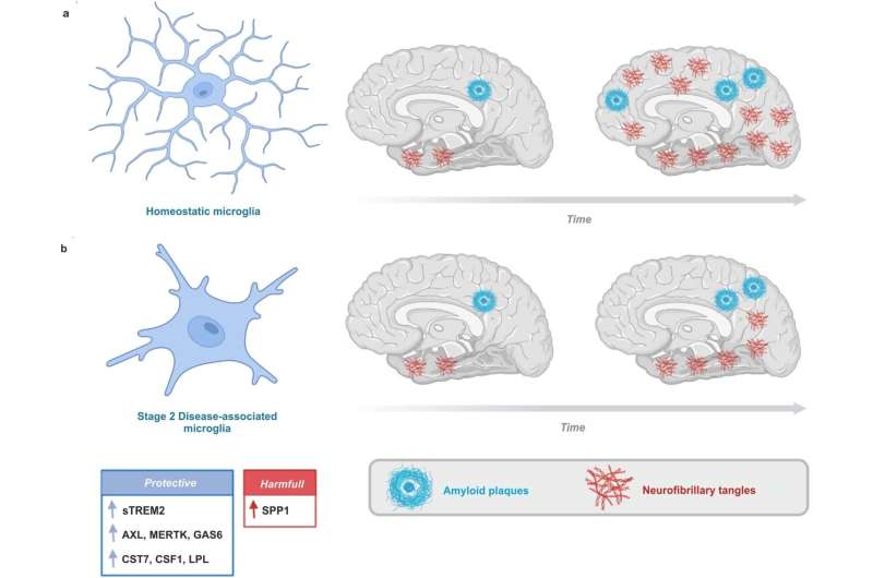 The brain's immune cells can be triggered to slow down Alzheimer's disease