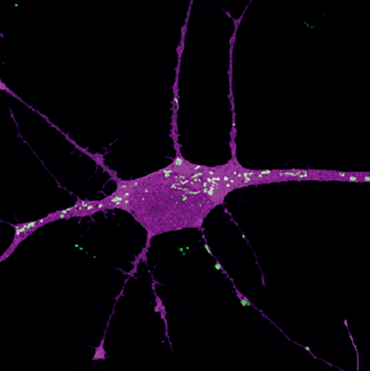 A purple human neuron with white mitochondria dotting the surface