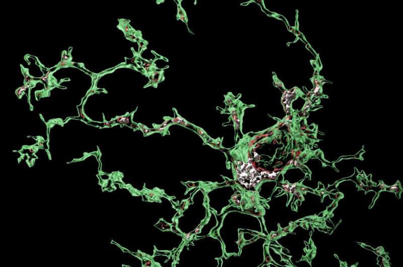 Perivascular cells could induce microglial malfunction associated with Alzheimer's disease