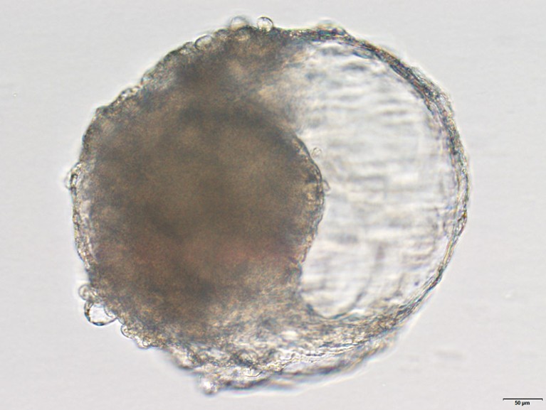 A microscope image of a cynomolgus monkey blastoid under modified TDM