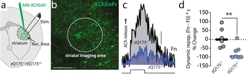 Uncovering the causes of neuron dysfunction in Huntington's disease 