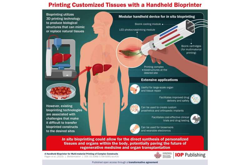 Bioprinting personalized tissues and organs within the body: A breakthrough in regenerative medicine