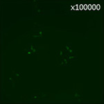 慢病毒滴度测定图