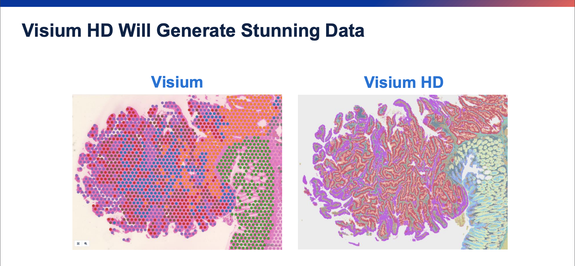 Visium HD Spatial Gene Expression - 10x Genomics
