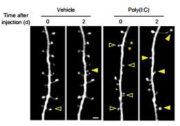 病毒感染条件下时,小鼠的树突棘200%的低于免疫系统未被激活的小鼠,这