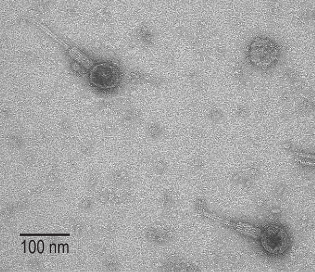 噬菌体显微镜下图片图片