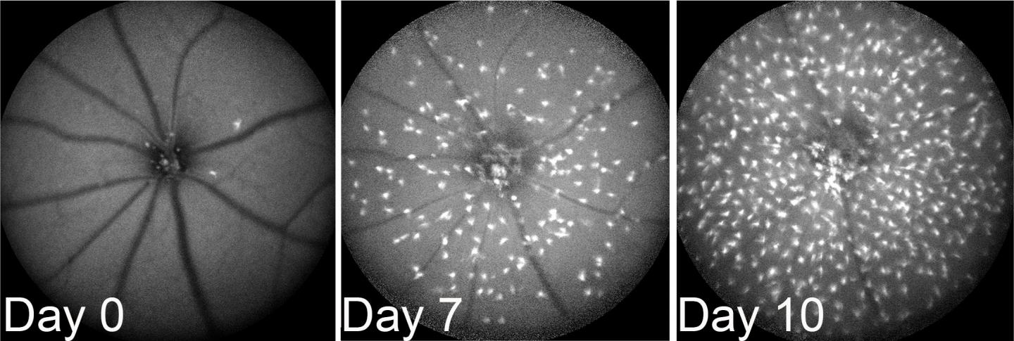 恢复视力的希望之火生生不息的视网膜小胶质细胞
