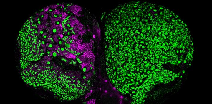 北大学者elife发文:神经祖细胞命运锁定,防止脑肿瘤